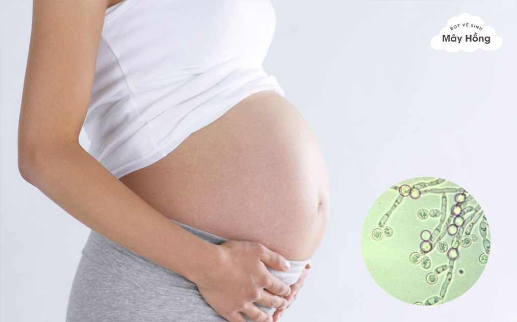 Nấm âm đạo khi mang thai