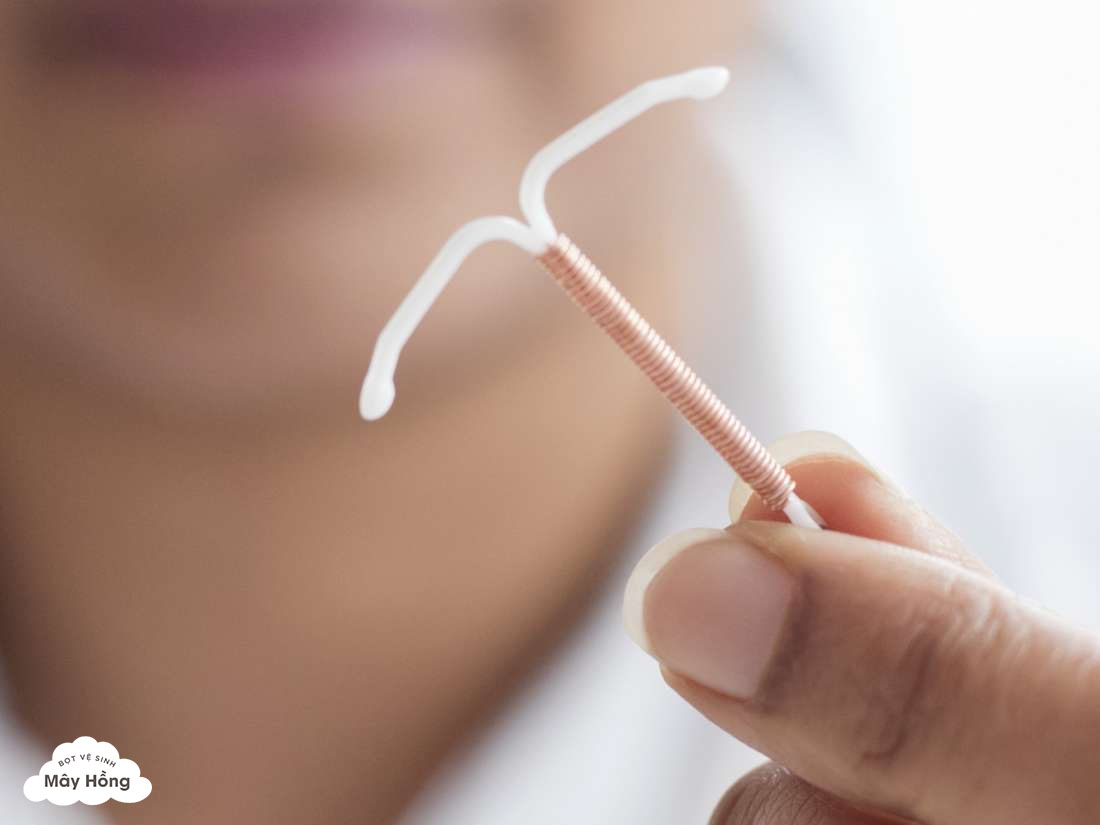 Đặt lệch vòng tránh thai cũng làm chảy máu vùng kín 